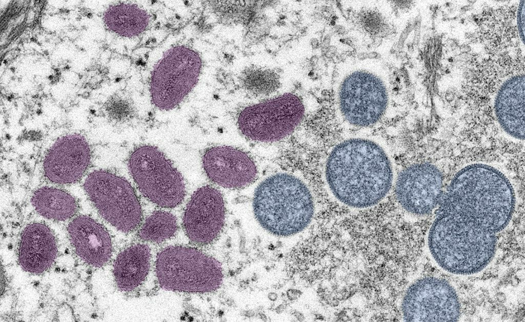 Monkeypox_CDC